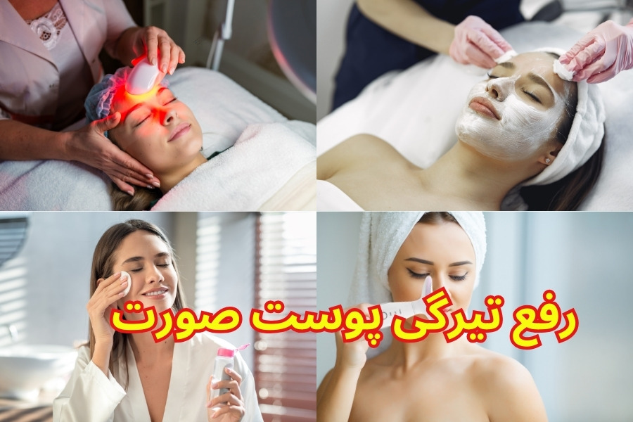 رفع تیرگی پوست صورت در منزل