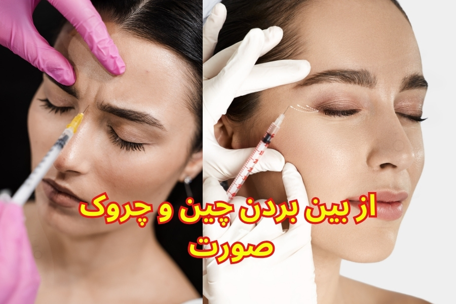 برای چین و چروک صورت چی خوبه؟