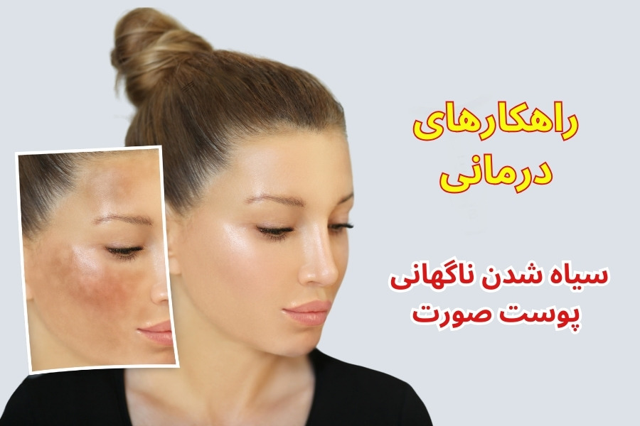علت سیاه شدن ناگهانی پوست صورت