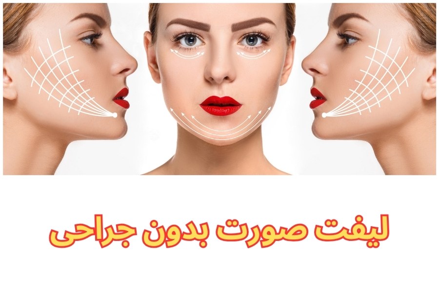  لیفت صورت بدون جراحی