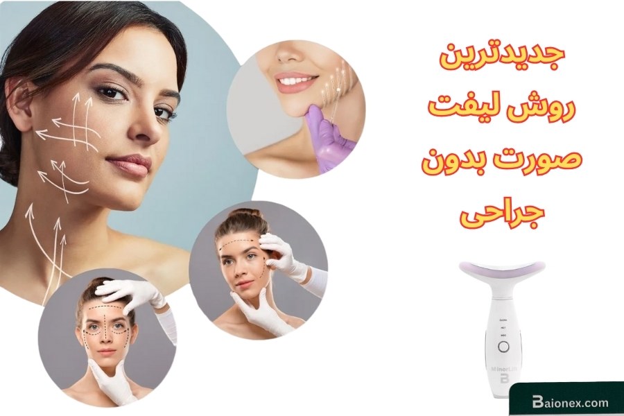 جدیدترین روش لیفت صورت بدون جراحی