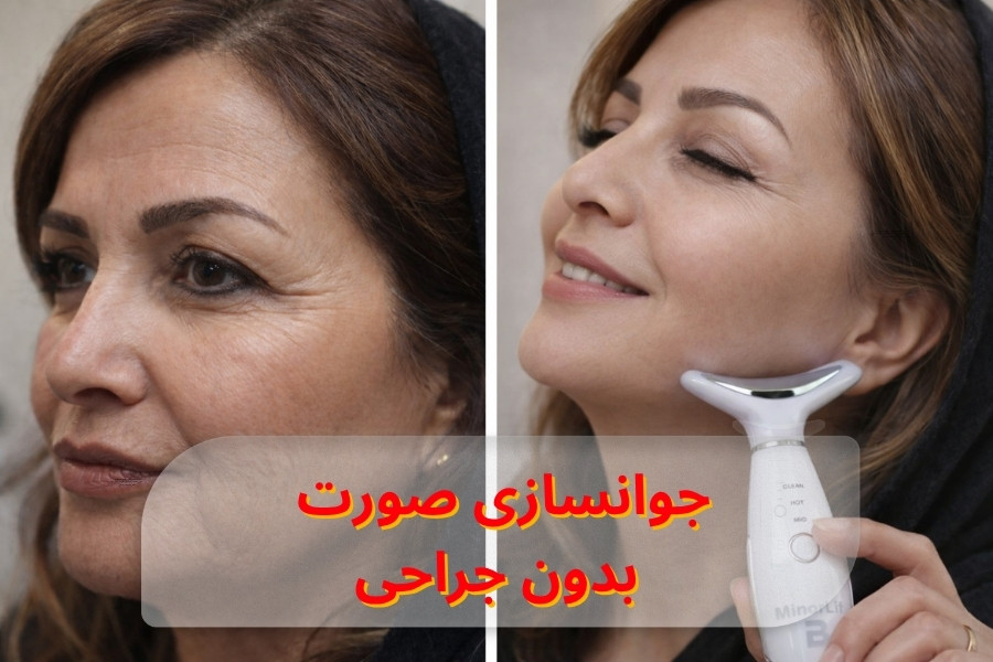 جوانسازی صورت بدون جراحی