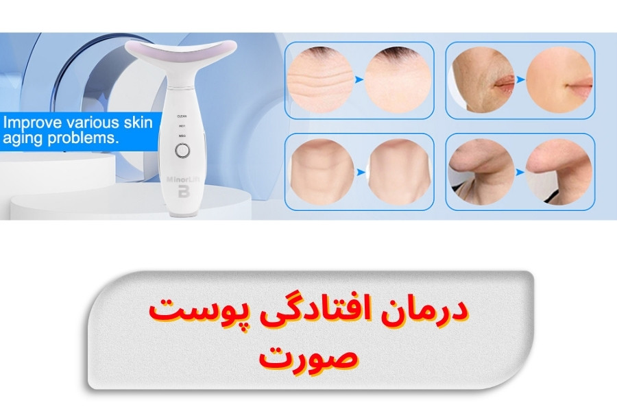 how-to-treat-sagging-face