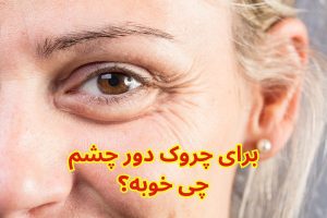 برای چروک دور چشم چی خوبه؟