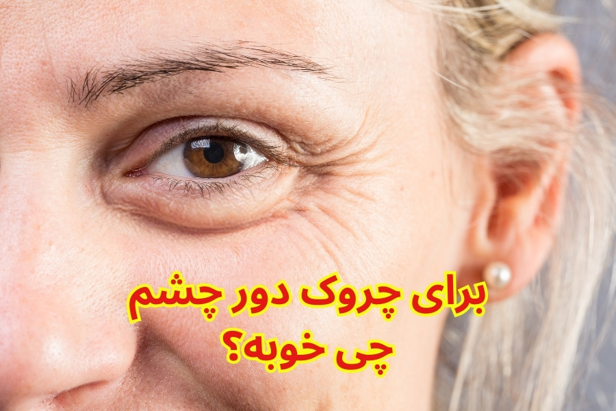 برای چروک دور چشم چی خوبه؟