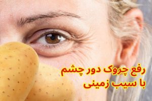 رفع چروک دور چشم با سیب زمینی