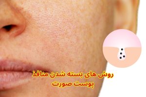 برای بسته شدن منافذ پوست صورت چه کنیم؟