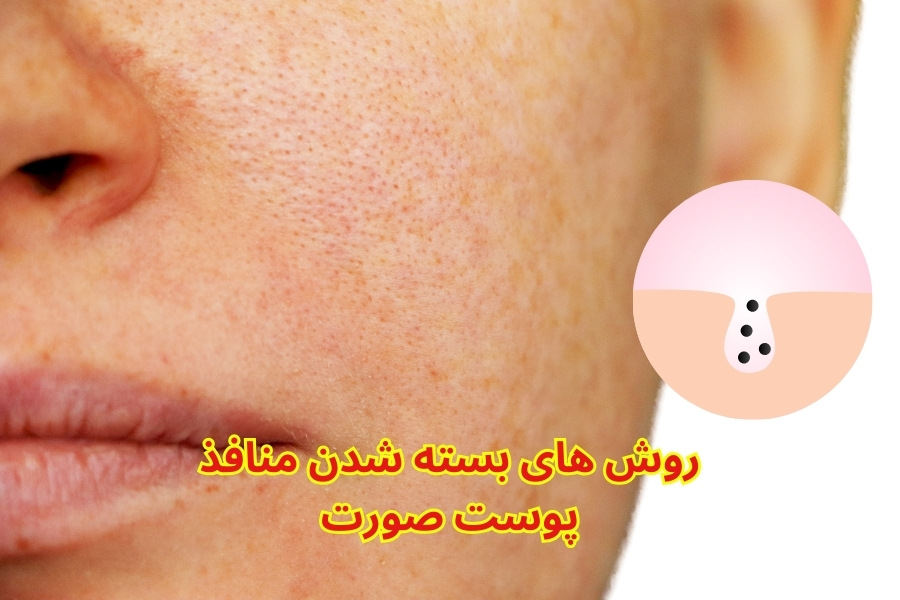 برای بسته شدن منافذ پوست صورت چه کنیم؟