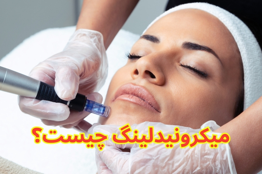 microneedling