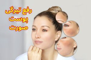 رفع تیرگی پوست صورت در منزل