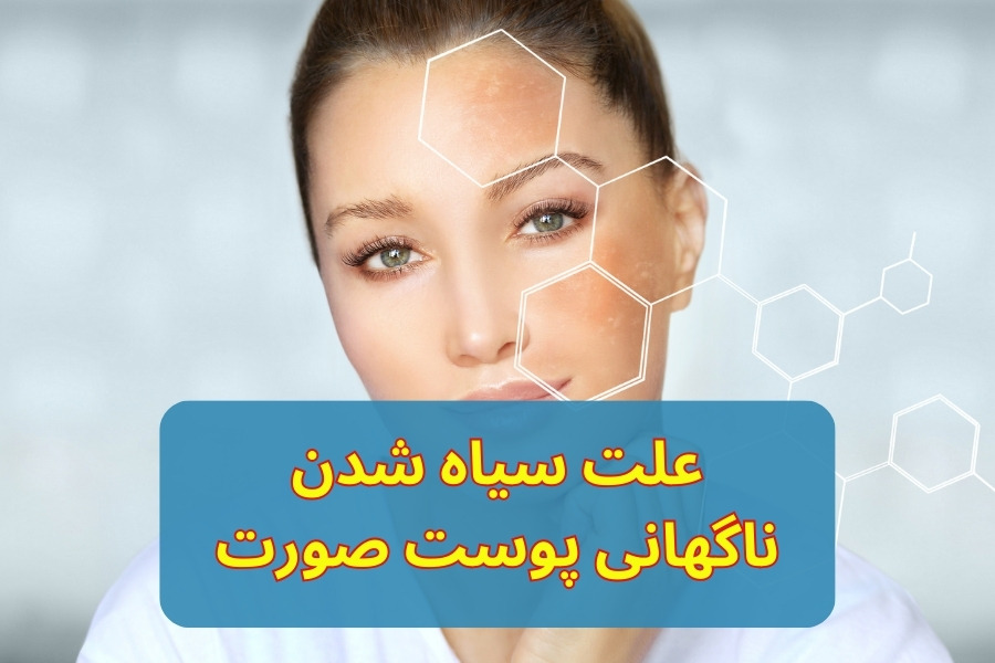 علت سیاه شدن ناگهانی پوست صورت