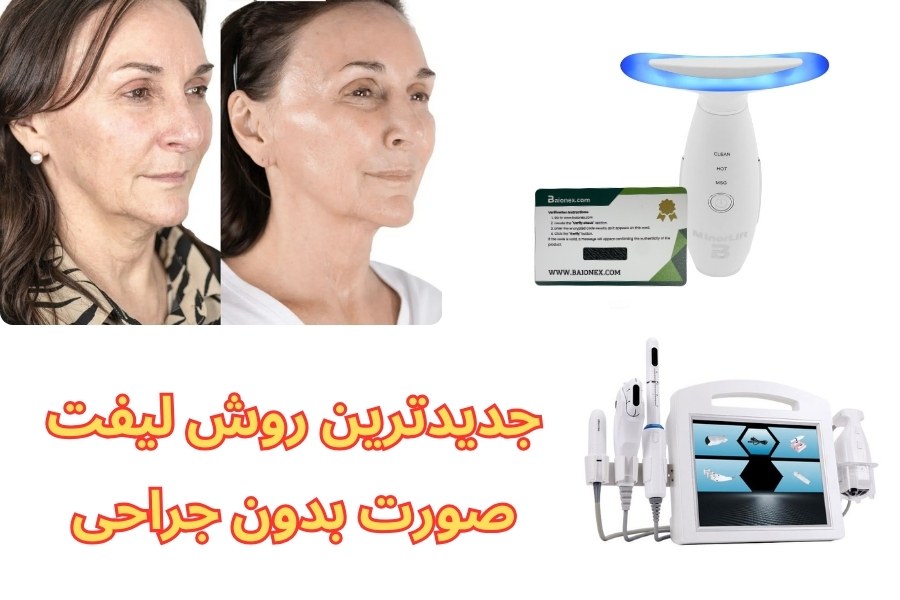 جدیدترین روش لیفت صورت بدون جراحی