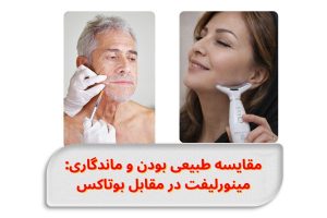 comparing-naturalness-and-durability-minorlift-vs-botox