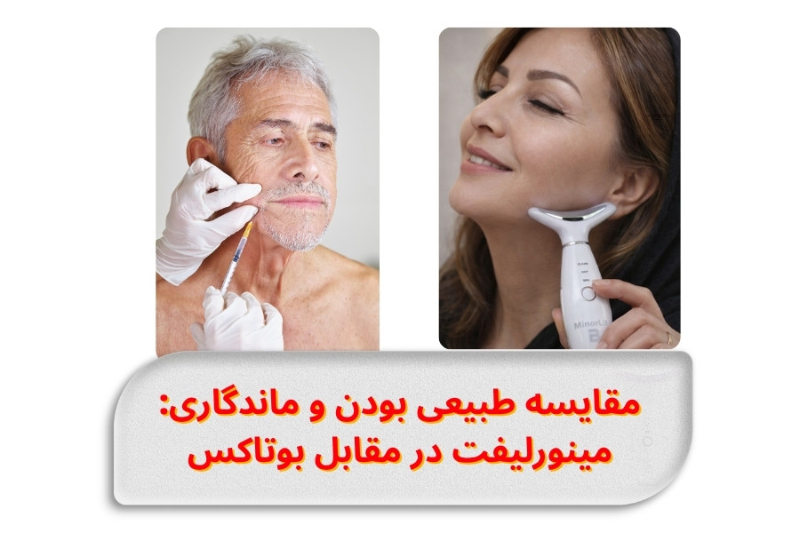comparing-naturalness-and-durability-minorlift-vs-botox