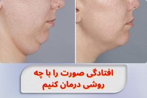 how-to-treat-sagging-face