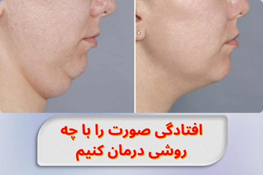how-to-treat-sagging-face