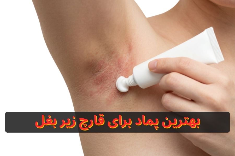بهترین پماد برای قارچ زیر بغل